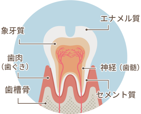 エナメル質の虫歯