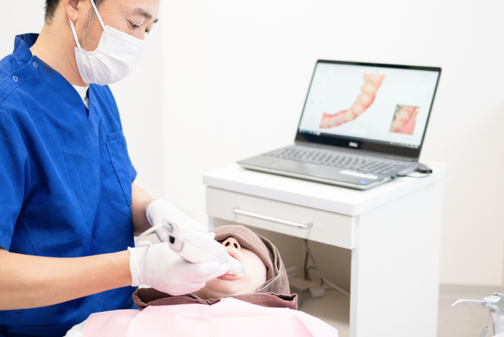 口腔内スキャナー