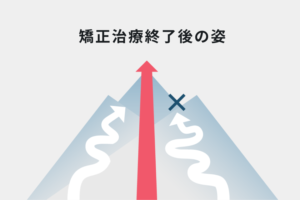 矯正治療終了後の姿