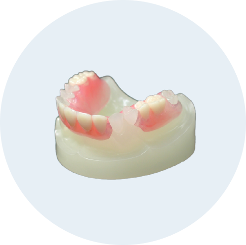 ノンクラスプデンチャー