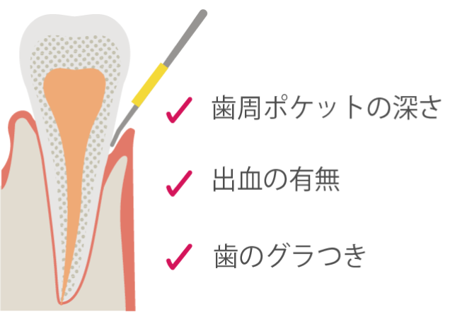 口腔検査・染め出し